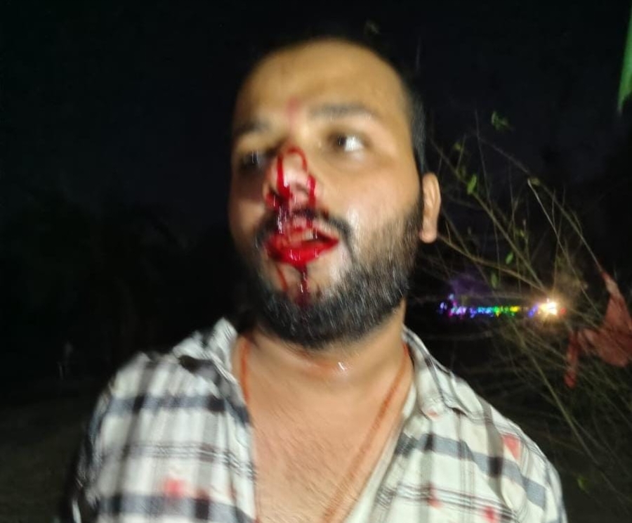प्रसाद वितरण कर रहें युवक पर धारदार हथियार से हमला
